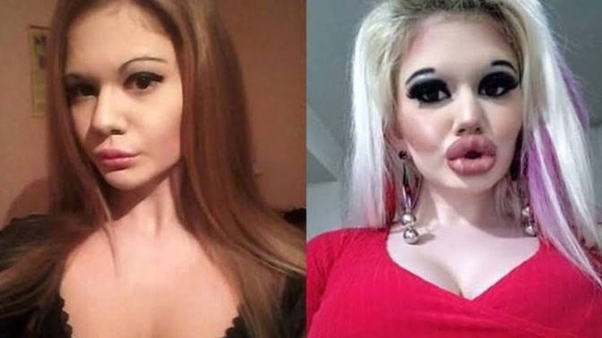 Estetik yaptırmayan kadın kaldı mı?