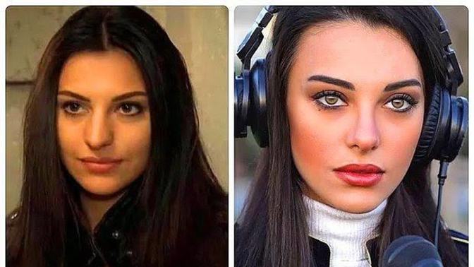 Büyük ve Kemerli Burun Güzelliği Çok Etkiler Mi?
