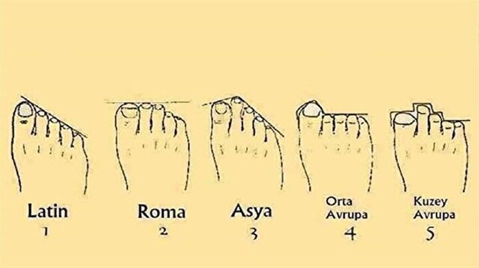 Ayak serçe parmağının yanındaki parmağın serçe parmağıyla aynı boyda olması engellilik durumumu mudur?