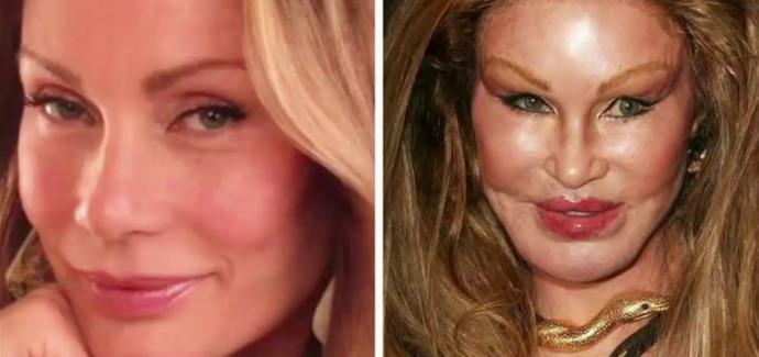 Jocelyn Wildenstein