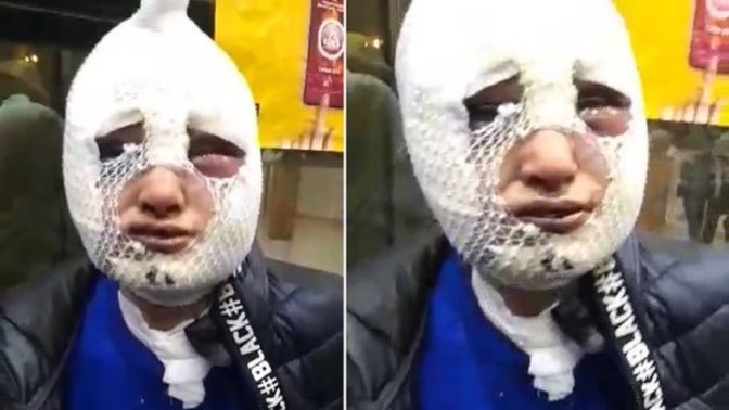Eski sözlüsünün başından aşağı kızgın yağ döken sanık tahliye edildi. Ne düşünüyorsun?