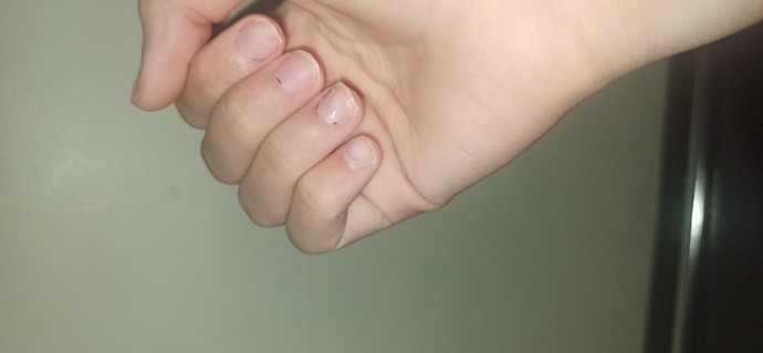 Sevgilim tırnaklarımı hep uzun ve bakımlı görüyordu ama protezleri çıkardım. İtici bulur mu?