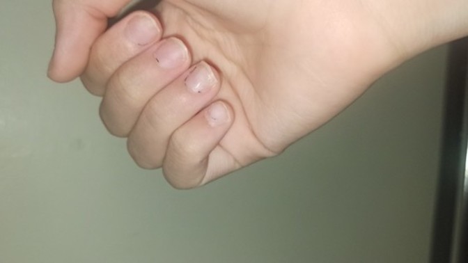 Sevgilim tırnaklarımı hep uzun ve bakımlı görüyordu ama protezleri çıkardım. İtici bulur mu?