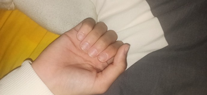 SİZCE tırnaklarım çok mu kötü sevgilimin midesi bulanır mı veya ay bu ne ellerin der mi?