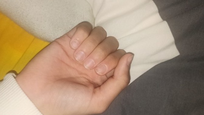 SİZCE tırnaklarım çok mu kötü sevgilimin midesi bulanır mı veya ay bu ne ellerin der mi?