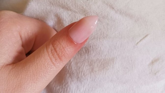 Arkadaşlar, tırnağım çok mu kötü duruyor?