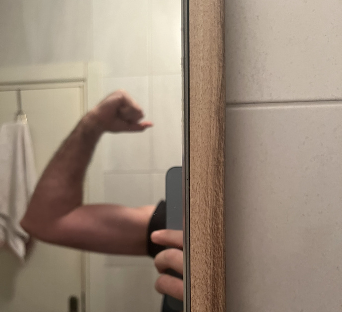 Biceps son durum?