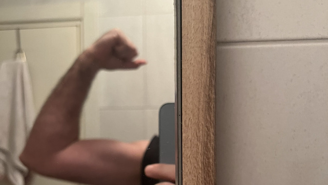 Biceps son durum?