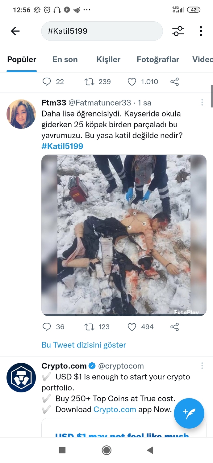Yıldız Tilbe: Saldıran köpeklere zehirli et verilsin hepsi gebersin! Sokak köpekleri sorunu böyle mi çözülür?