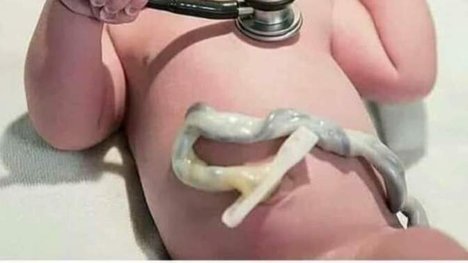 Bebeğiniz doğduğunda kordon bağını bağışlamayı düşünür müsünüz?