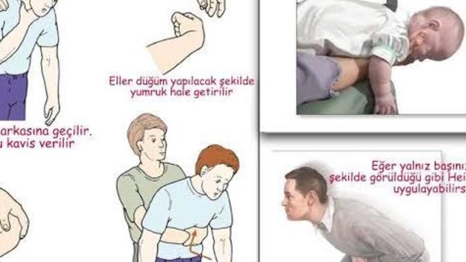 Heimlich manevrasının doğru uygulanışını biliyor musunuz?