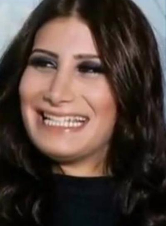 Gülüşümü sevmiyorum?