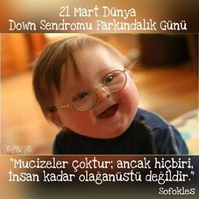 Bugün Down sendromu günü. Siz bu sendromun farkında mısınız?