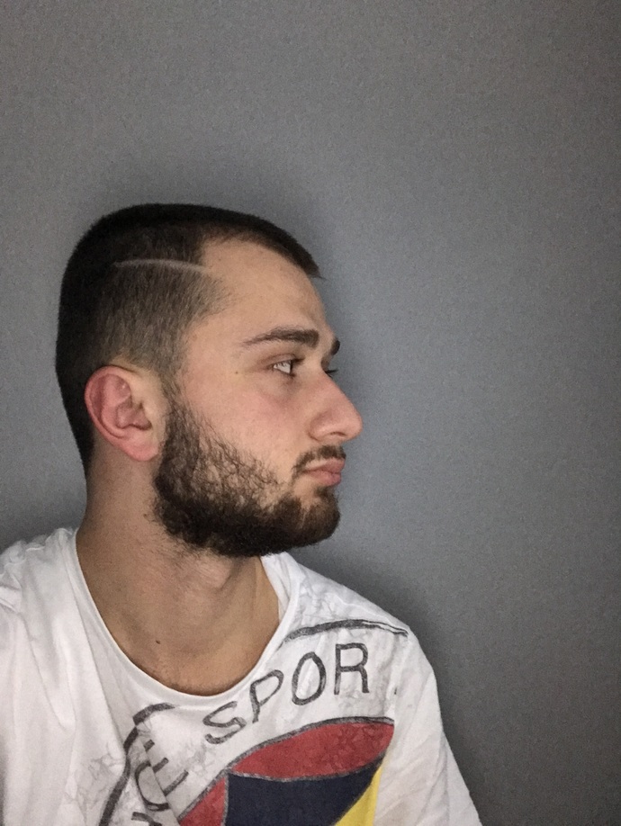 Saçlarım çok döküldüğü için saçımı kestirdim sizce nasıl olmuş çok kararsız kaldım?