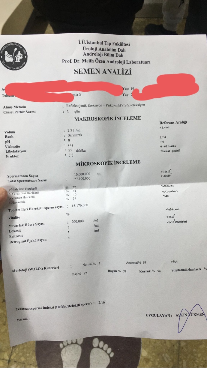 Sperm testinden anlayan var mı acaba? Varikosel hastası kardesimin 19 yaşında?