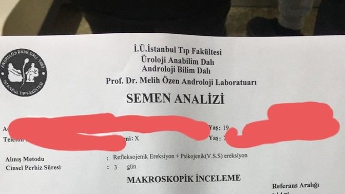 Sperm testinden anlayan var mı acaba? Varikosel hastası kardesimin 19 yaşında?