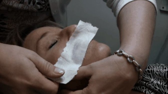 Dudak üstü tüylerin en iyi çaresi nedir?