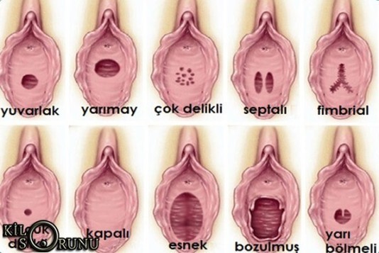 Merak ettiğim bir şey var okur musunuz?