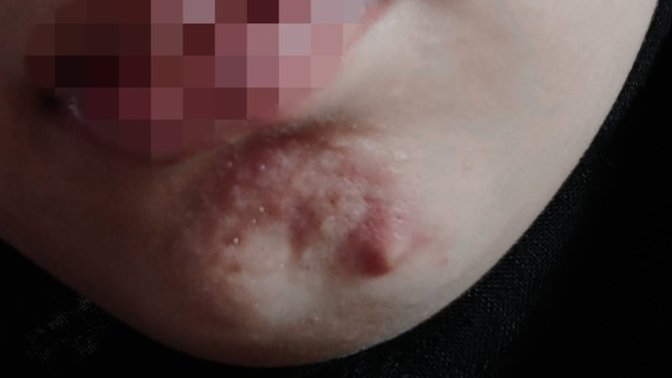 Cildim böyle çok mu kötü sizce?