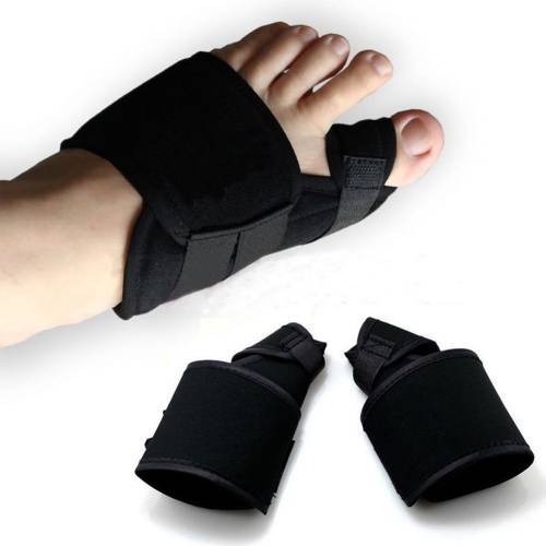 Ayaklarımda halluks valgus (kemik çıkıntısı) var, ameliyat olmalı mıyım?