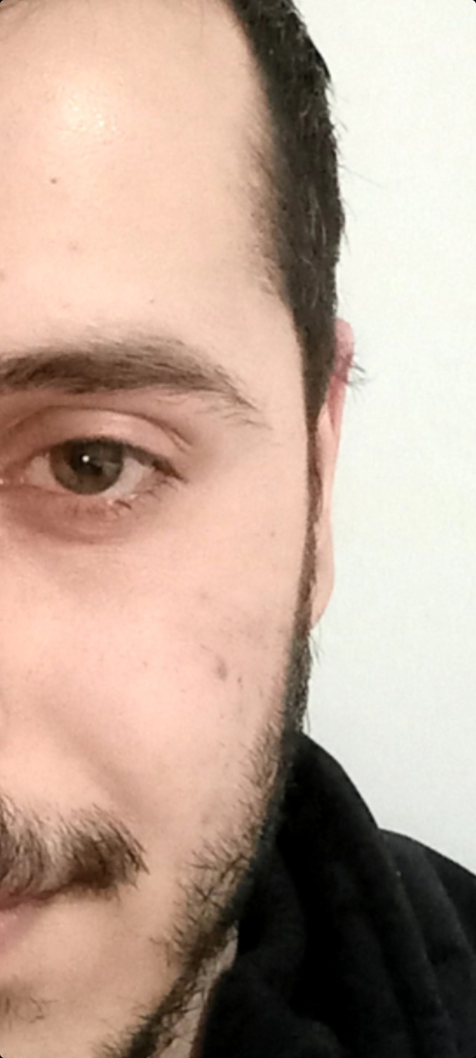 şu an ki hali. Siyah nokta gibi