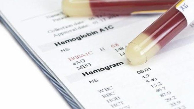 Kan tahlili vb sonuçları çıkınca doktora götürmeden internette araştırır mısınız hangi kısaltma neymiş diye?
