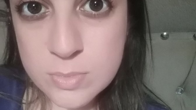 Nasılım? göz altı çukurlarımdan nasıl kurtulabilirim?