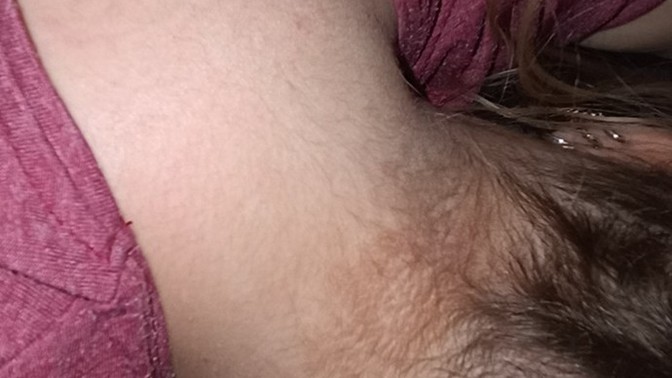 Bunun niye tedavisi yok?
