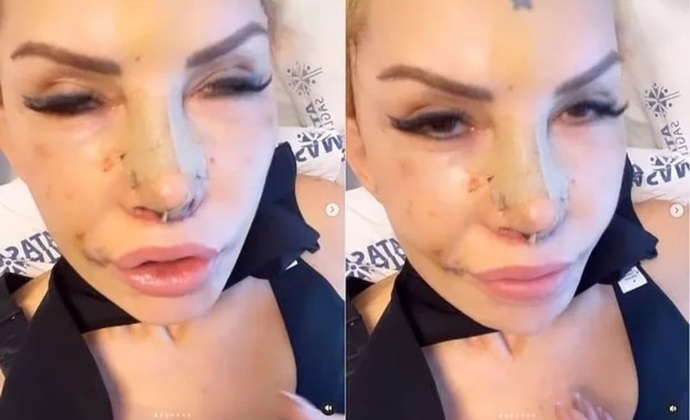 Seyhan Soylu, Filiz Akına benzemek için 1 milyon lira harcamış! Birine benzemek için para harcamak mantıklı mı?