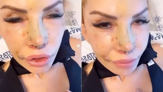 Seyhan Soylu, Filiz Akın'a benzemek için 1 milyon lira harcamış! Birine benzemek için para harcamak mantıklı mı?