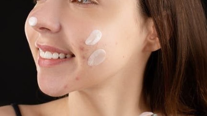 20 yaşından sonra sivilce sorunu neden oluşur?