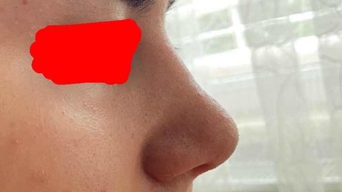 Burnumu yaptırdım sizce şekli güzel olmuş mu?