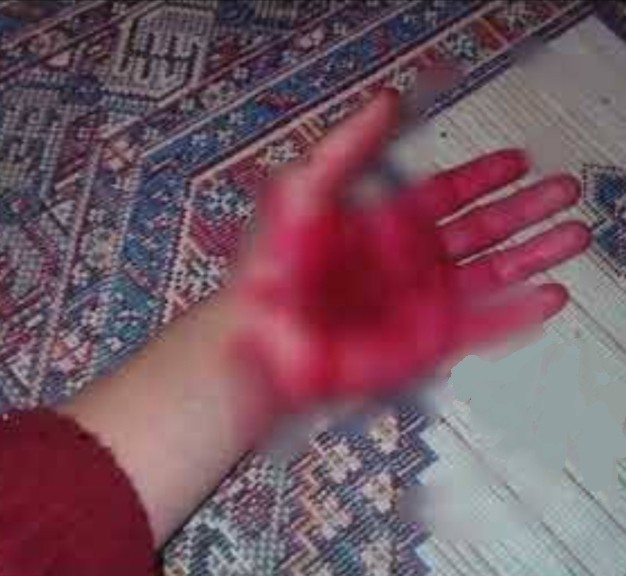 Mastürbasyon yapan erkeklerin eline bir şey olur mu?