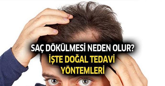 Arkadaşlar saç dökülmesine en doğal çare nedir?