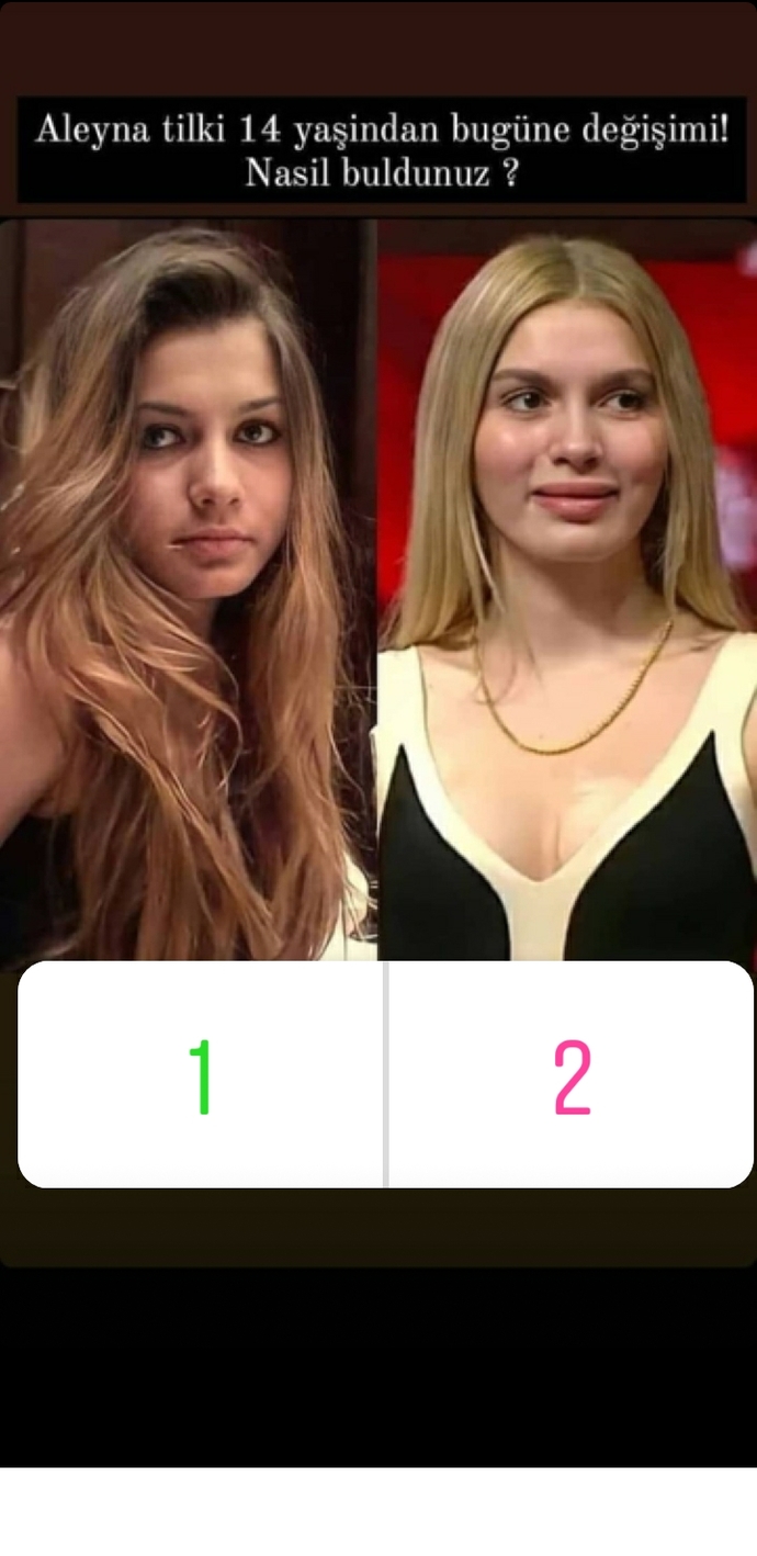 Aleyna Tilki güzel mi sizce?