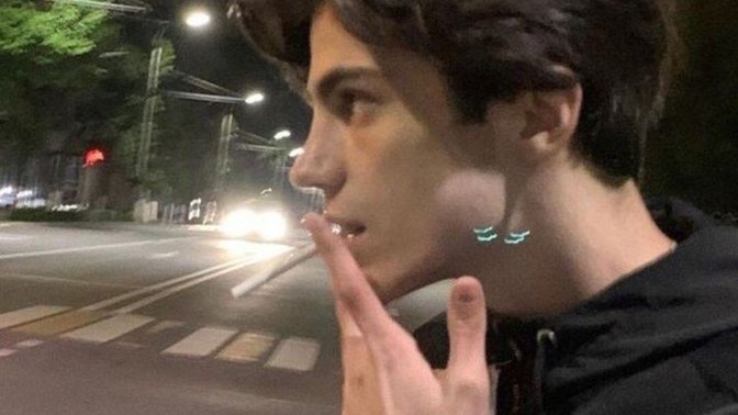 Erkeklerde hangi saç sorunları oluyor?