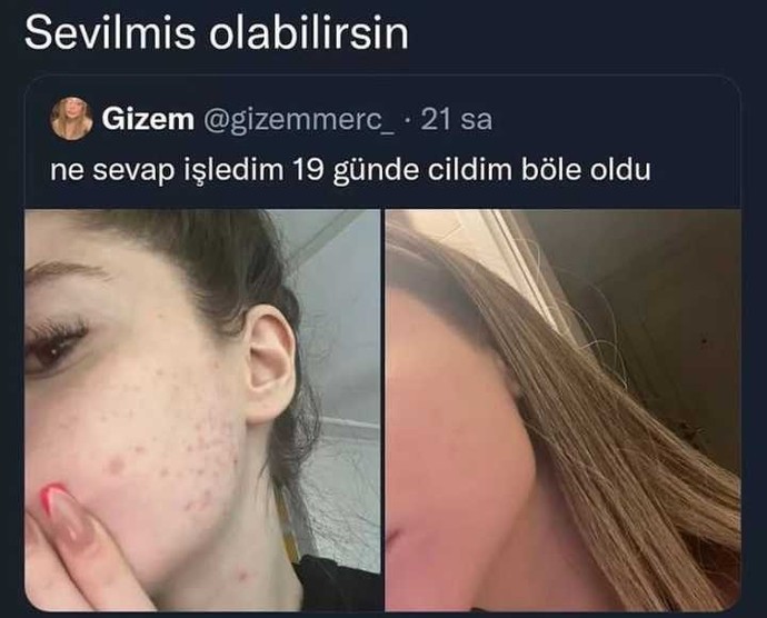 Sevilmek güzelleştirir mi?