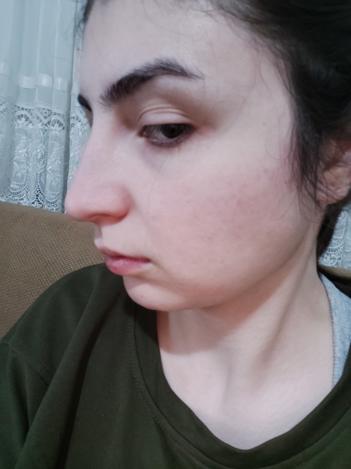 Burnum büyük mu yaptırmalı miyim?