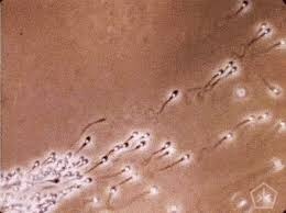 Sperm cilde ve daha birçok şeye iyi geliyormuş deneyen var mı?
