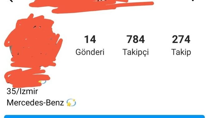 Nasıl bu kadar vizyonsuz olunur😂?