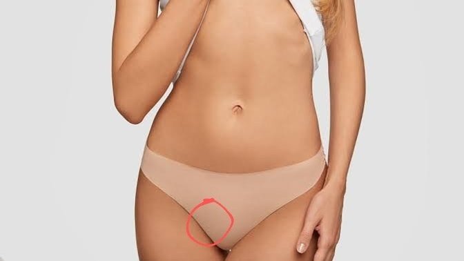 Bikini bölgemdeki şişliği sebebi ne sizce? acil yardım ediinn?