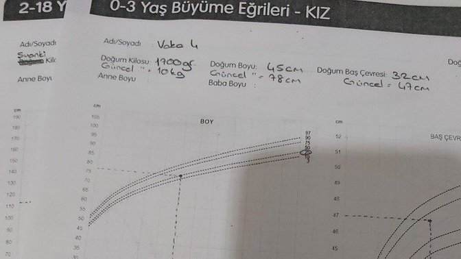 Persentil eğrisi yorumlanabilir var mı bana yardım edebilecek biri?