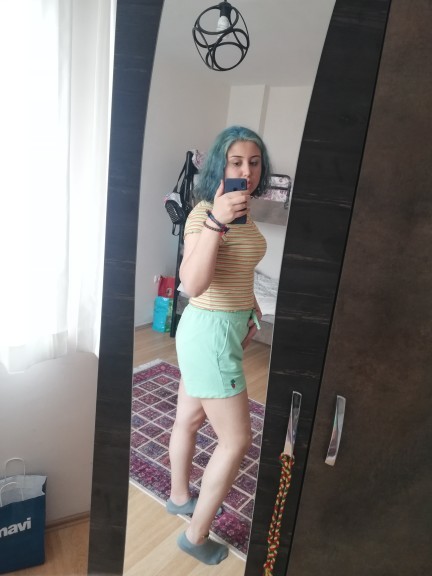Göbeğim çok mu kötü duruyor?