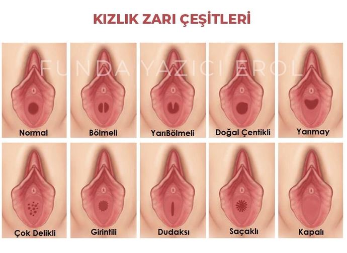 Spiral bakirelere takılır mı?