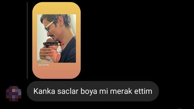 Beyazlayan saçlarınızın boya olduğu düşünülse ne tepki verirsiniz?