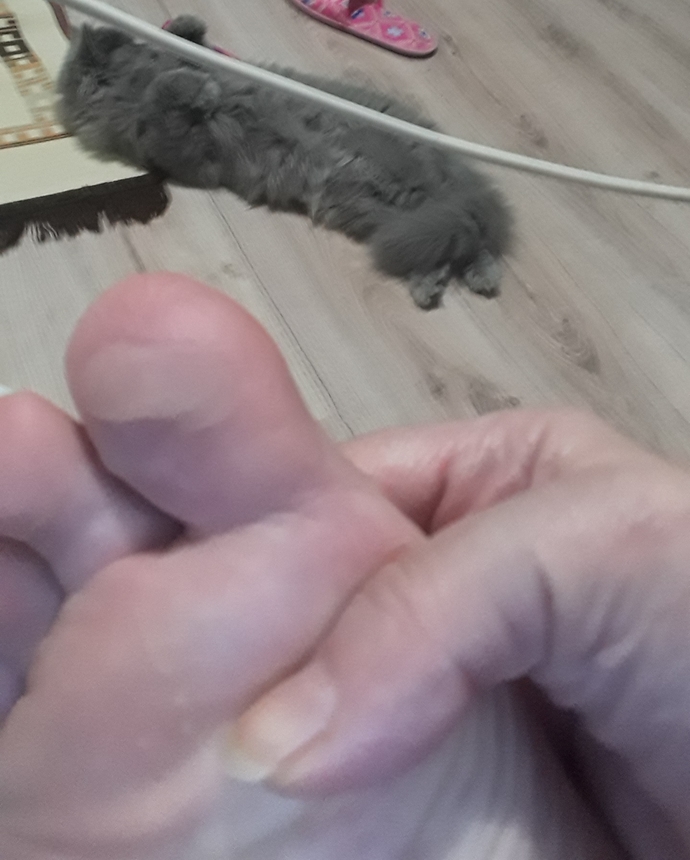 Ayağım kötü oldu ne sürmem gerek?