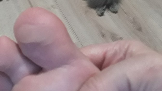 Ayağım kötü oldu ne sürmem gerek?