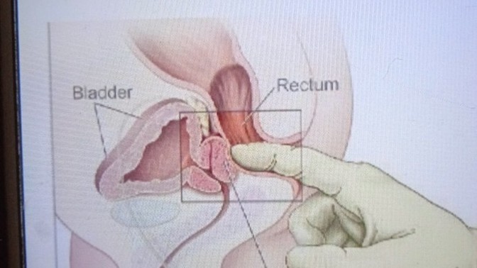 Sözde muayene yöntemi rektal tuşe neden daha uzun ve kalın olan orta parmak ile yapılmaz?