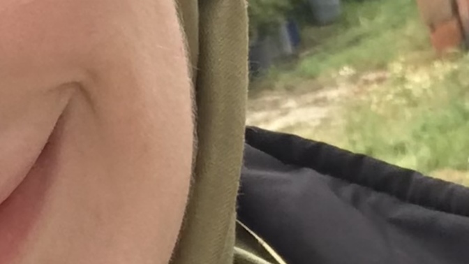 Yüzdeki tüyleri ne yapabilirim? çok çirkin mi duruyor?