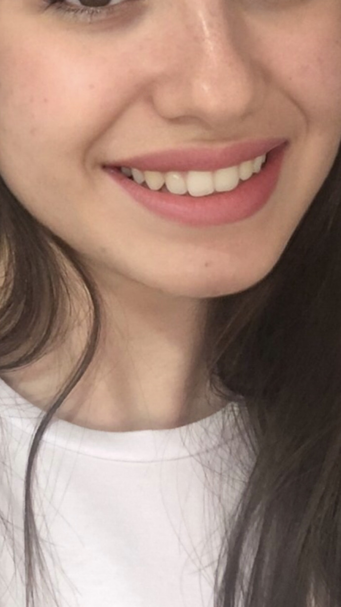 Dişlerim nasıl sizce?